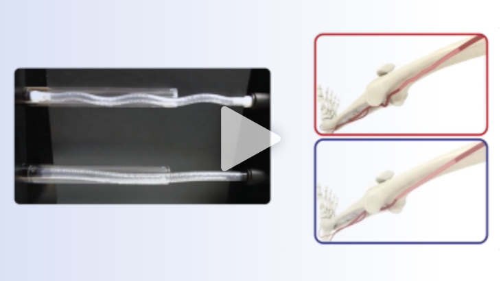 BioMimics 3D® Vascular Stent System